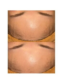 銀座シノ 灯 HANARE(shino)/丸みのある綺麗なおでこに