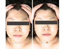 ここはなの雰囲気（NRマシン小顔・引き上げコースであごラインがシャープで小顔に♪）