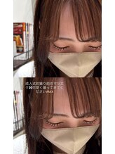 ビューティマーケット アングゥ(BEAUTY MARKET ungu)/どの角度からも可愛く！