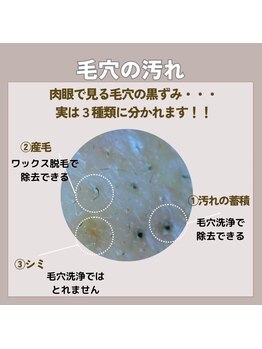 マヴィ 守口店(MavY.)/毛穴目立ちの原因は様々！