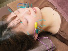 たく鍼灸整骨院