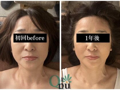 キュープ 富士店(Qpu)の写真