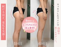 ボルテージ マーキュリー 湯島本郷店(Voltage Mercury)