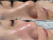 ナチュールムーン(Nature moon.)の雰囲気（毛穴ちゅるんっ♪思わず触れたくなる、ふんわりむきたまご肌☆）