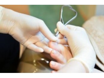 ドクターネイル爪革命沖縄/爪切りケア