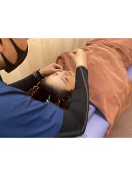 鍼灸施術を受けたい