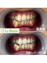 ルブラン 奈良店(Le Blanc)/お試しクーポンから