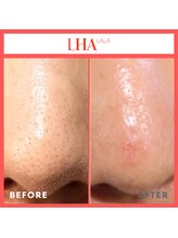 ラウ 広島呉店(laut)/韓国ララピール