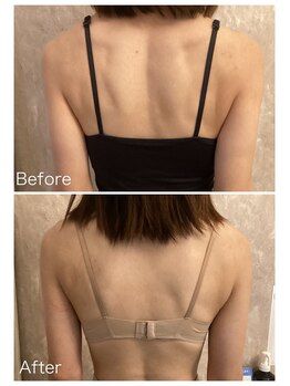 プレミドール(PREMIDOLL)/肩・背中のコリで辛い方！