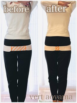 ヴェール 青山(vert)/骨盤矯正【ビフォーアフター】