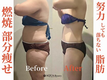 ビーエスアクアビューティーの写真