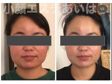 あいはな/肌質改善にも効果あり