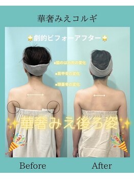 アコガレコガオ 鳥取店/コルギのビフォーアフター