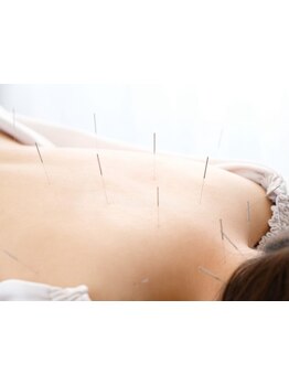 首・肩のつらさを改善したい