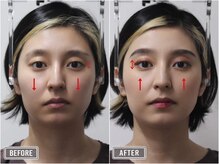 さつま骨格矯正 表参道青山院/歪み小顔矯正＋骨盤矯正