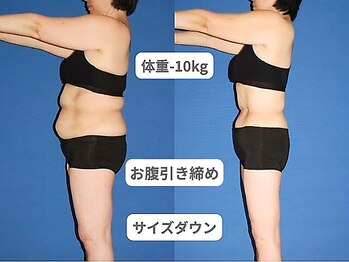 ピュアノア 垂水店/痩身ダイエット 神戸垂水明石