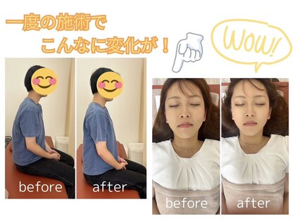 鍼灸サロン ヒマワリ(himawari)の写真