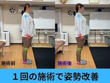 アオ整体院/お客様のビフォーアフター☆