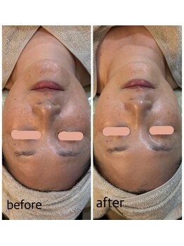 ルームドットエヌ(room.n)/アンストレス 水光肌