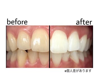 セルフホワイトニング NUA 東大宮駅前/