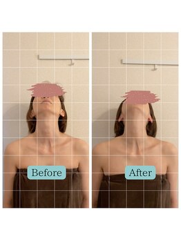 ユリラ(Yu'ReLa)/首肩周りの不調、違和感に！