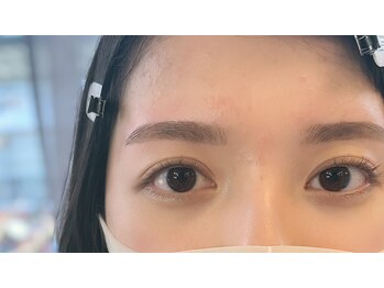 ダフネ(DAFNE)/女の子から女性に