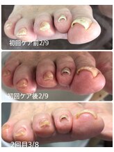 シェリエット(Cheriette)/