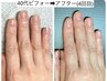【自爪で綺麗な爪になりたい人】究極のネイルケア6回コース ¥33000