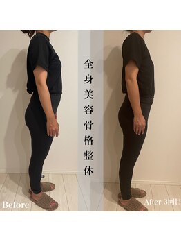 アール アンド ビューティーサロン(Ｒ＆ BeautySalon)/全身美容骨格整体