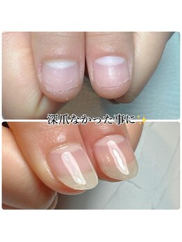 自爪風長さ出し