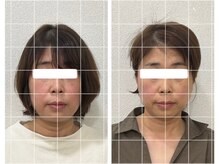 カラダボ 戸塚店の雰囲気（顔の大きさ、左右差、自律神経にもアプローチする小顔矯正）