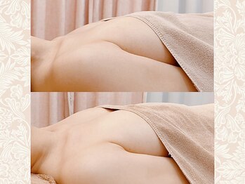 アネラ 北浜(ANERA)/40代/巻き肩&猫背/バストケア