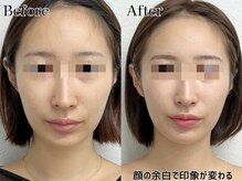 プルチャームエテルナ 代官山店(Pulchram eterna)/ライン矯正+リンパ+機械