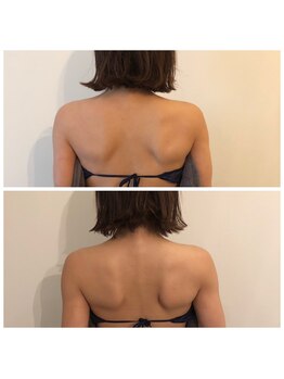 ミチカケ トリムリターン那覇市店/筋トレ女子憧れの背中美人！