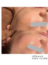 マヴィ くずは店(MavY.)/メラショット！