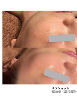 マヴィ くずは店(MavY.)/メラショット!