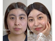 ハナ 佐賀店(hana)/まつげパーマ/眉毛/パリジェンヌ