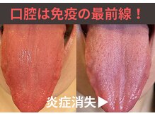 グラント(Grant.)の雰囲気(【インナーケア】免疫を正常化するためには正しい口腔ケア必須!)