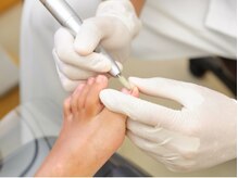 ドクターネイル爪革命沖縄/巻き爪ケア