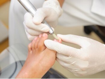 ドクターネイル爪革命沖縄/巻き爪ケア