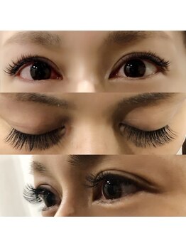 アルファ(alpha)/デザイン5