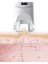 FACE（1）熱や電気を与えずに、ふっくらとハリのあるフェイスへ