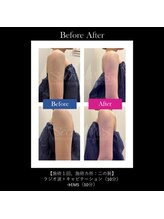 ナチュラル ビューティー ベルポート(natural beauty Bellport)/シークレットmes導入