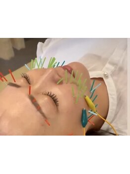 鍼灸施術を受けたい