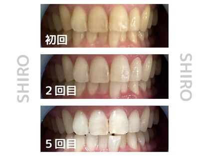シロ 海老名店(SHIRO)の写真