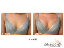 シャルムココ 蔵前店(CharmeCoCo)/お客様Before→After
