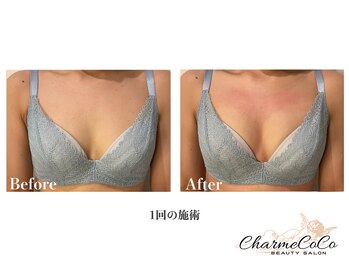 シャルムココ 蔵前店(CharmeCoCo)/お客様Before→After