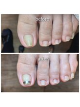 爪切り屋 足楽/