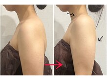 エクラ(e'clat)/ブライダル姿勢コース