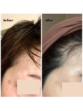 小顔専門サロン ラリューシュ(La ruche)/劇的若戻り変化